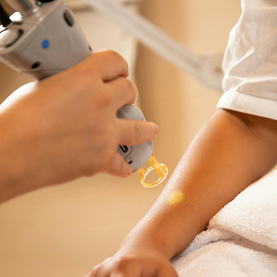 Aesthetic doctor shining a yellow light onto a patients arm