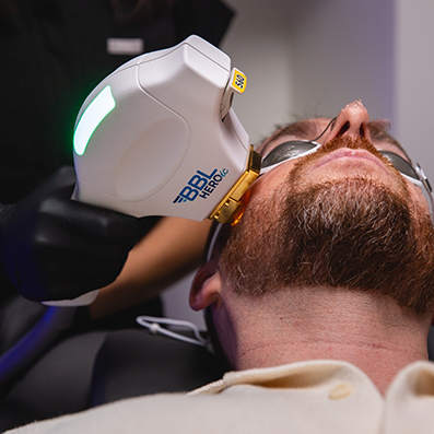 Aesthetic doctor holding a light laser device to the face of a bearded man