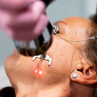 Aesthetic patient with a laser device touching her cheek